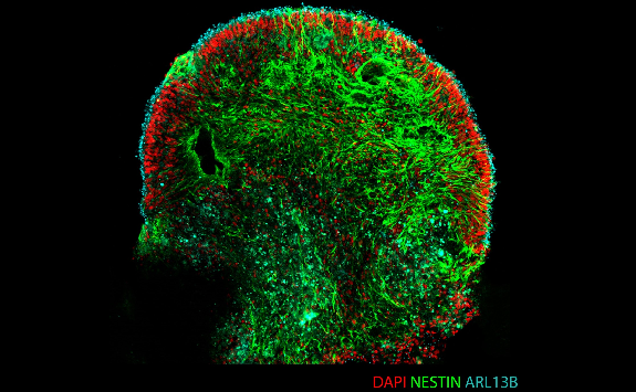 Immunofluorescence-image-retinal-organoid